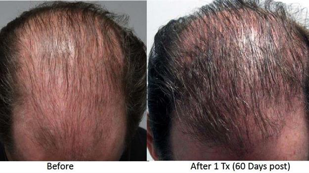 beforeandafter beforeandafter