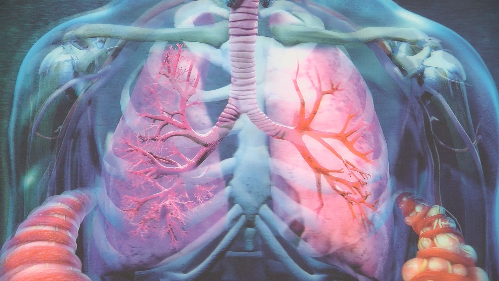 Lungs